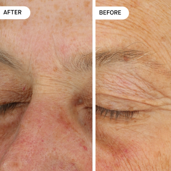 WonderSpray™ Anti-Aging Spray