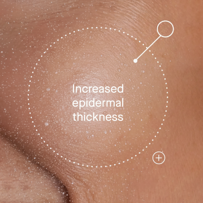 WonderSpray™ Anti-Aging Spray